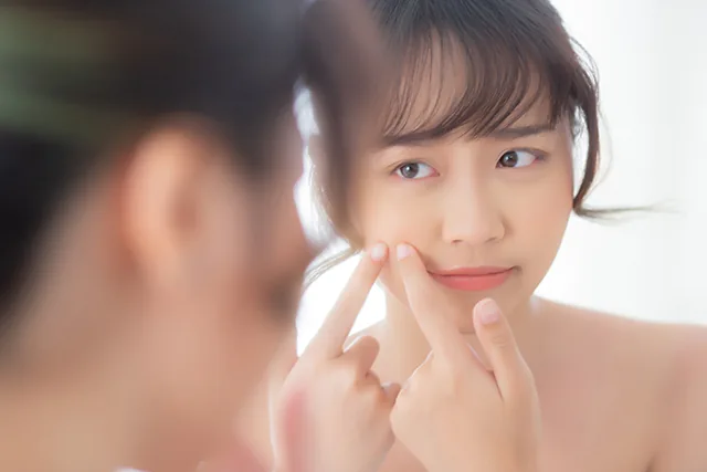 Acne Management