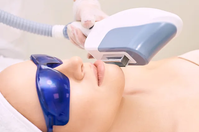 Non-Surgical Face Lift & Rejuvenation (Ages 35–65)