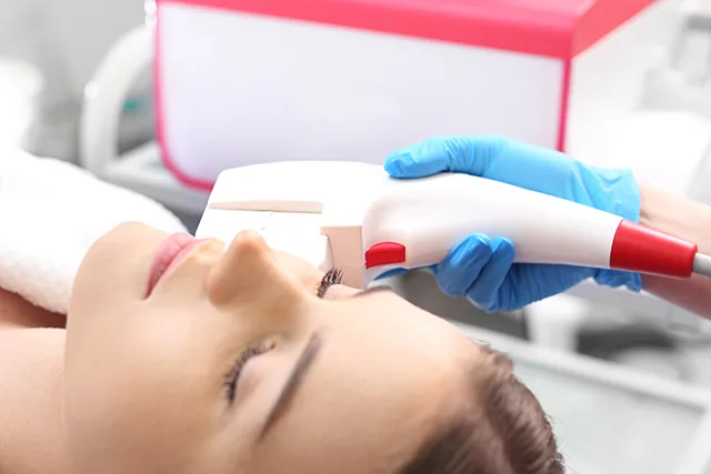 LASER Skin Resurfacing & Remodelling
